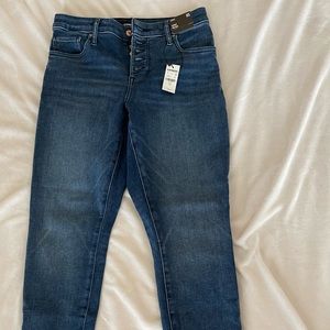 Express Curvy Button Fly Skinny Jeans